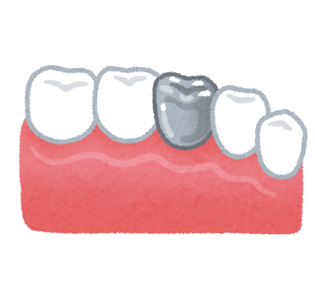 銀歯以外の治療とは ひらのファミリー歯科
